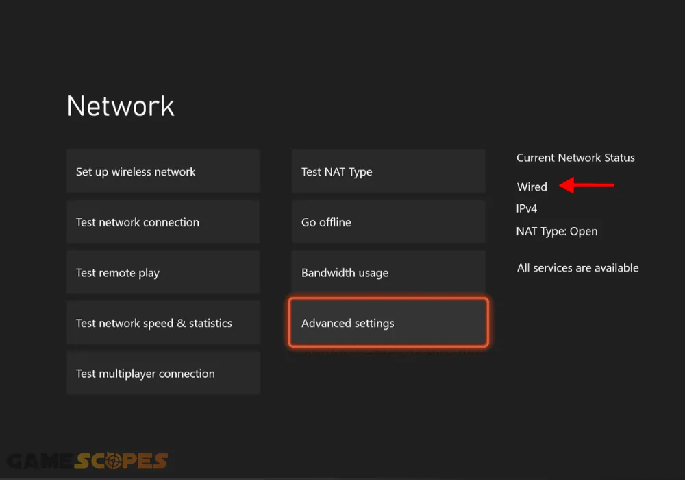 The image visualizes how to inspect your internet connection on Xbox.